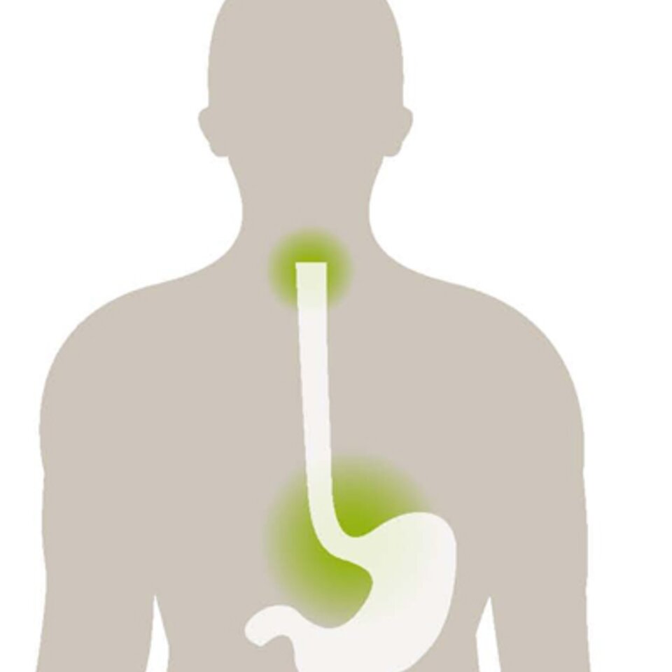 Reflux graphic