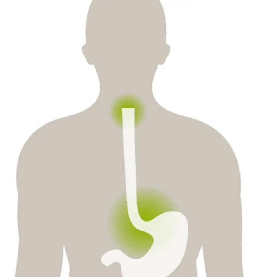 Reflux Grafik