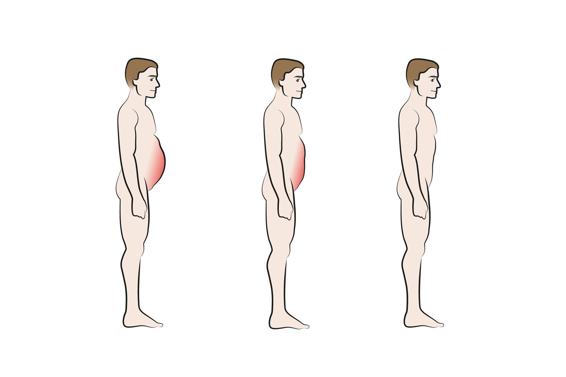 Bauch-Illustration
