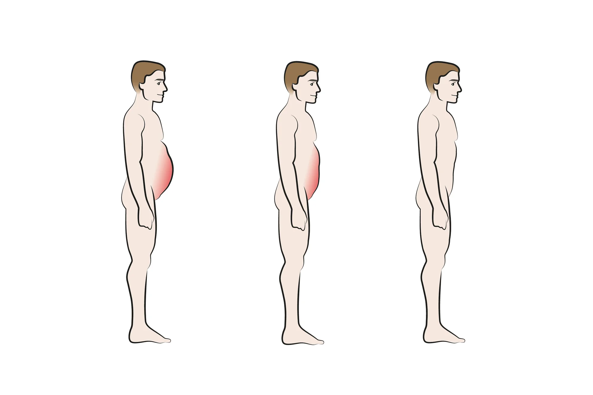 Bauch-Illustration