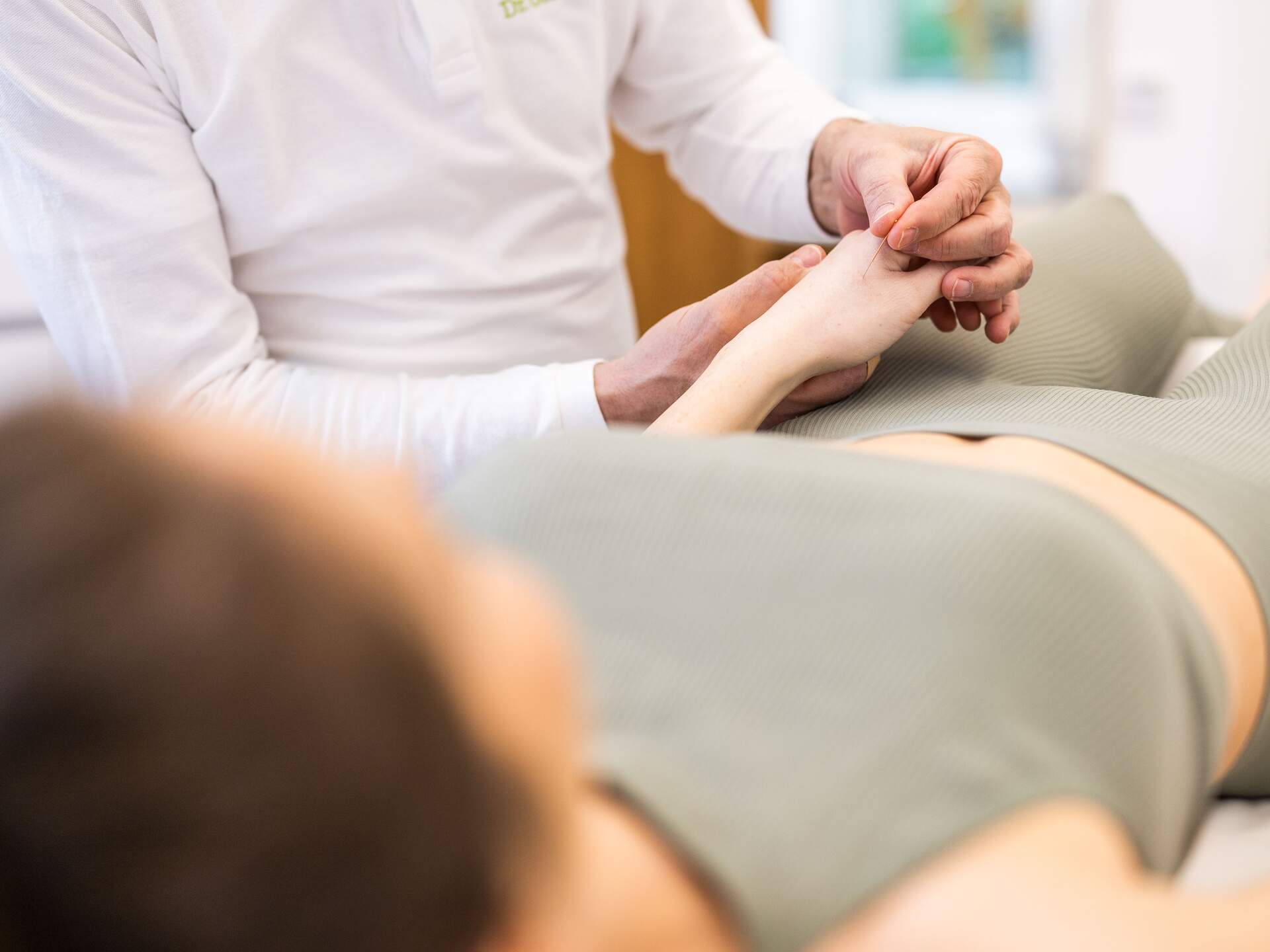 Woman receiving acupuncture