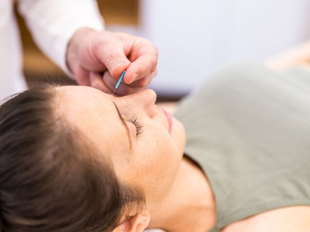 Acupuncture treatment