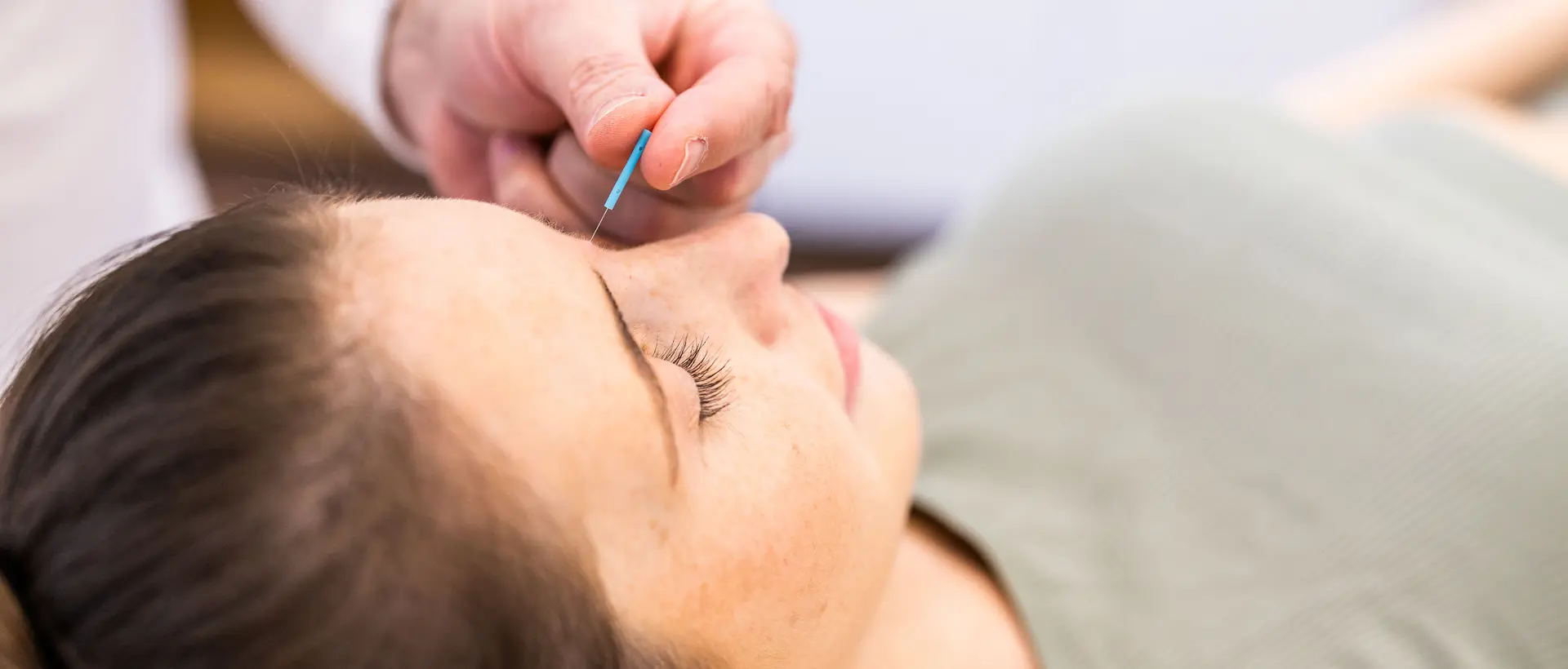 Acupuncture treatment